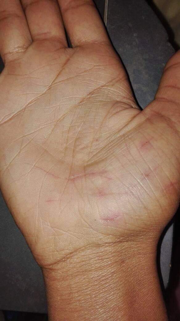 thebeprincemon1's tweet photo. I'm happy that I'm healing... 3 months without self harm. #fightdepressionwithgod https://t.co/YXdXcLdyhw