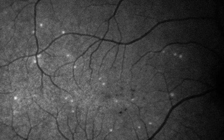SLSingh's tweet photo. AI-supported test for very early signs of glaucoma progression - 
"A new test can detect glaucoma progression 18 months earlier than the current gold standard method, according to results from a UCL-sponsored clinical trial."
https://t.co/FDNVeNZFNh https://t.co/SnUCYGZKiN
