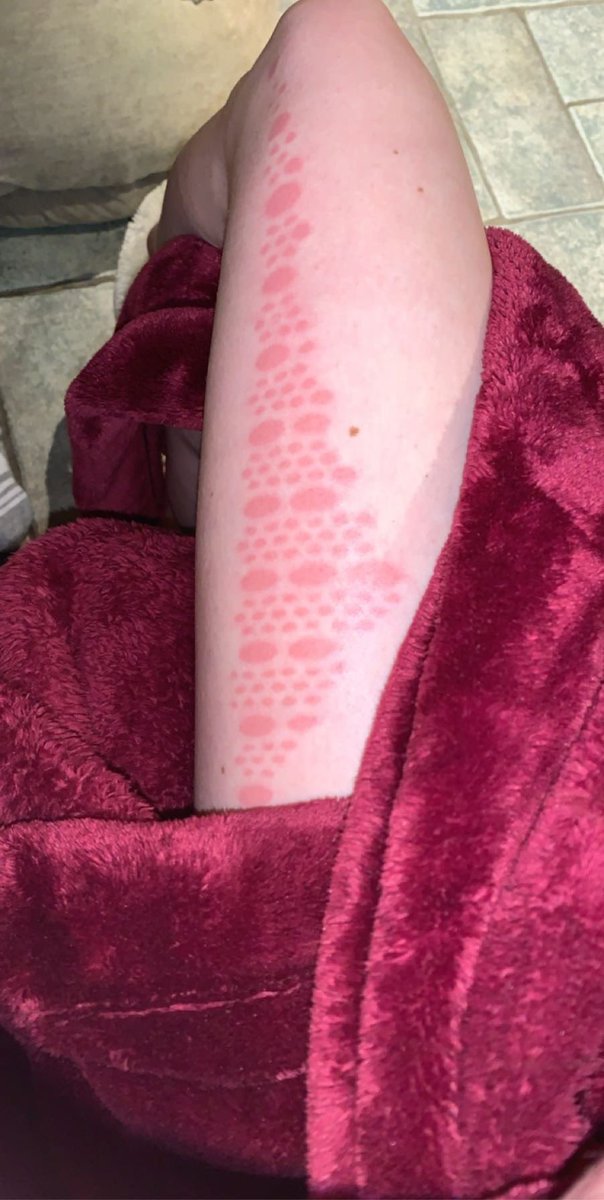joannelawriee's tweet photo. Never again will I go cycling in the sun with cut out patterned leggings 🙃 https://t.co/MFCYH0b8bM