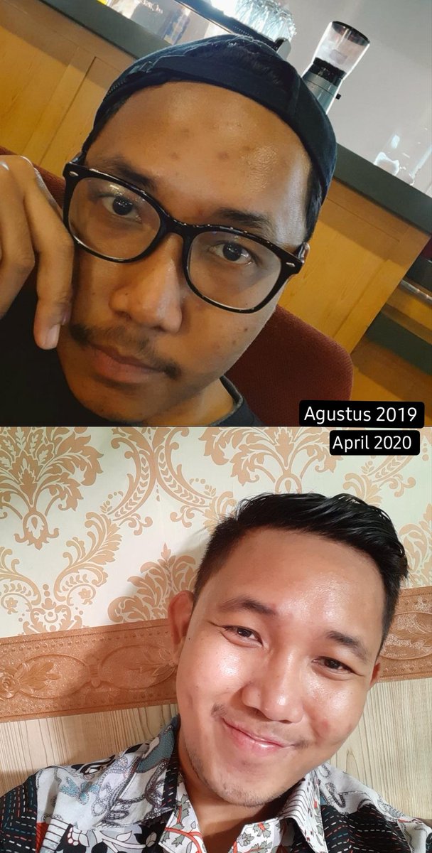 rawrrrtbl's tweet image. Skincare routine buat wajah berminyak dan gampang berjerawat 101

====A THREAD====