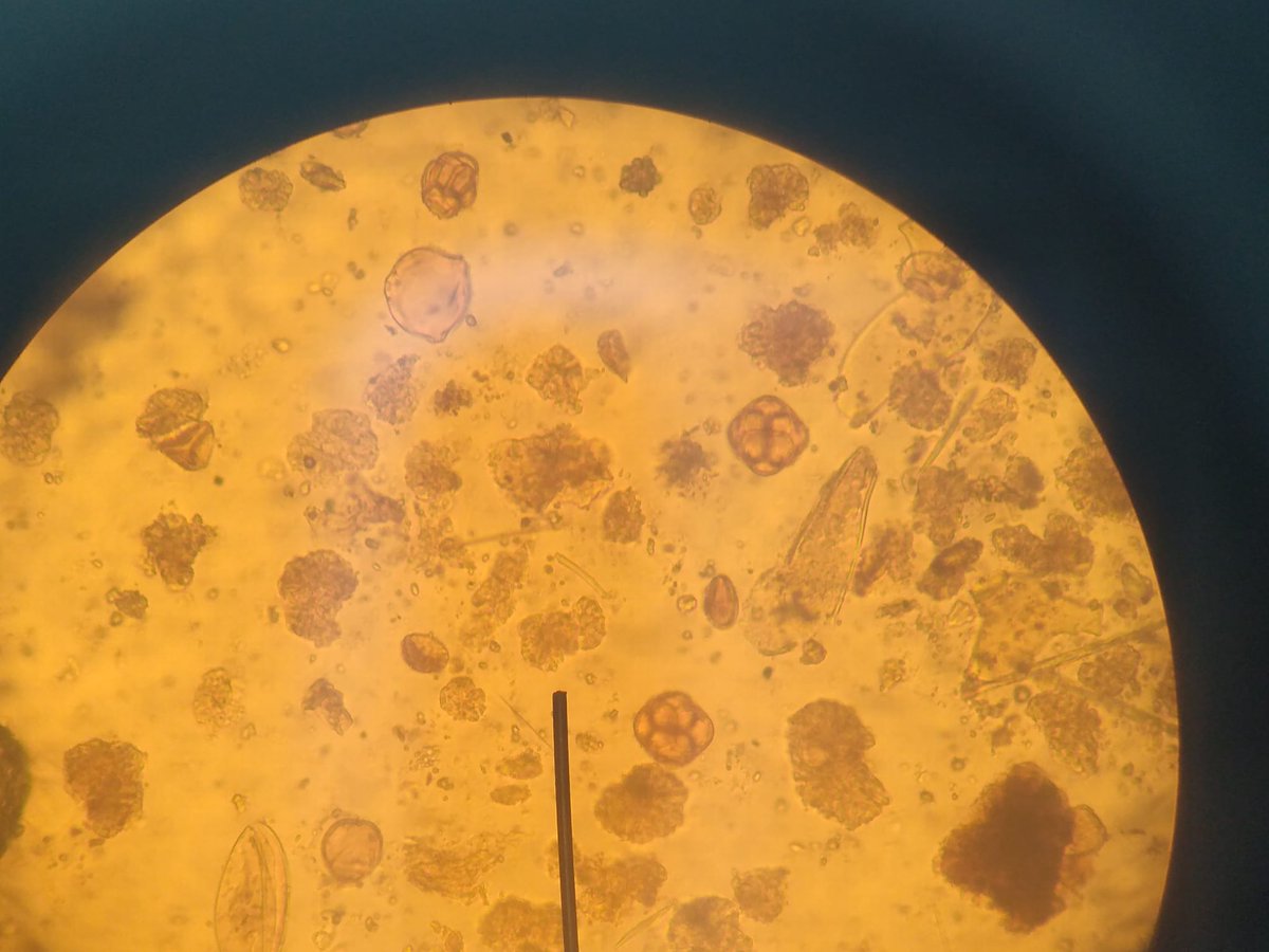 josuaran's tweet photo. Nice assemblage to start the pollen counting. Mediterranean Iberia #MIS4 #Pleistocene #palynology https://t.co/kghfaQciqq