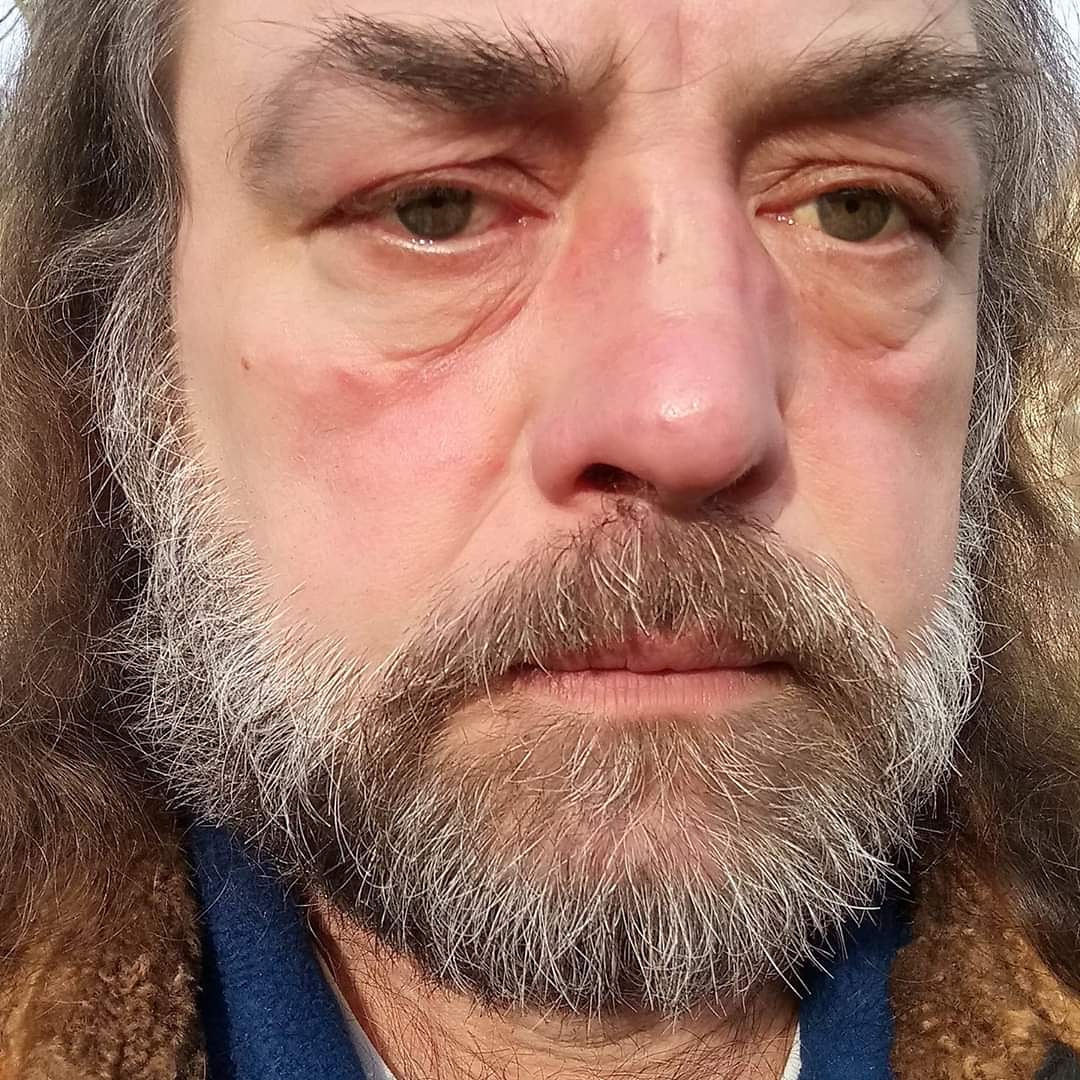 peter_kunisch's tweet photo. @SEATofficial 🇩🇪🐺🍺🍀🌹Habe nichts🌹🍺🌹und will nichts🌹🍺🌹war 20 Jahre mit Schnuffelchen zusammen Darmkrebs ENDSTADIUM😭jetzt bin ICH ein Penner in einem Pennerheim😭und wollte MICH 3 mal umbringen😇jetzt WARTE ICH das MEINE Erlösung kommt🐺Tschüß oder und auch CIAO🌹🍀🍺🐺🇩🇪 https://t.co/4hQbXR493O