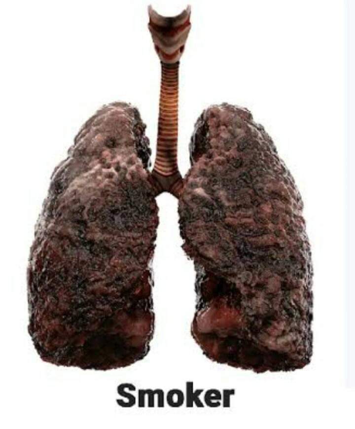 NdaKizito's tweet photo. Did you know that smokers are at higher risk of fatality than non-smokers regarding COVID-19? https://t.co/beVzAveiag