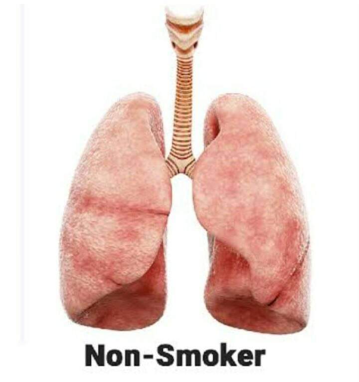 NdaKizito's tweet photo. Did you know that smokers are at higher risk of fatality than non-smokers regarding COVID-19? https://t.co/beVzAveiag