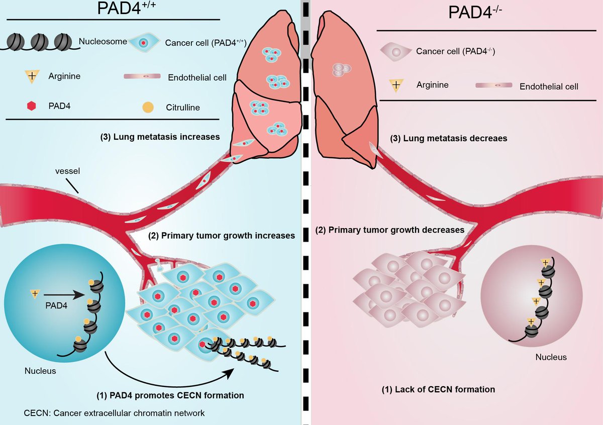 Molecular Cancer Research (@mcr_aacr) on Twitter photo #PAD4 plays a cell autonomous role in #CancerMetastasis by mediating the formation of #CancerExtracellularChromatinNetworks, Shi et al. report here: bit.ly/2T3pgYH
<a href="/PSUScience/">Penn State Eberly College of Science</a> <a href="/huckinstitutes/">Huck Institutes</a> #PAD4 plays a cell autonomous role in #CancerMetastasis by mediating the formation of #CancerExtracellularChromatinNetworks, Shi et al. report here: bit.ly/2T3pgYH
<a href="/PSUScience/">Penn State Eberly College of Science</a> <a href="/huckinstitutes/">Huck Institutes</a>