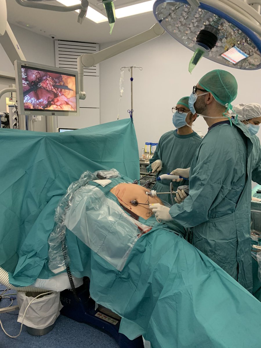 carlospetrola's tweet photo. Primera Colecistectomía laparoscópica (técnica francesa😉) con el gran Dr. José Luis Sánchez. It’s like riding a bike 😌. #SurgeryRocks 💪🏻 https://t.co/lxNHZ6CSat