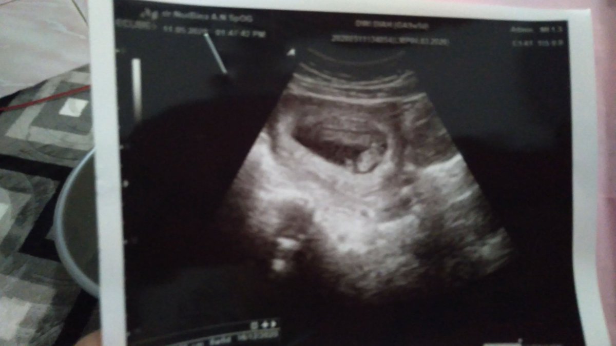 Hello...anak mama 😍🤗, semoga Allah senantiasa jaga dan lindungi kamu ya nak. Sehat2 dalam rahim mama. See u on dec ya ❤️