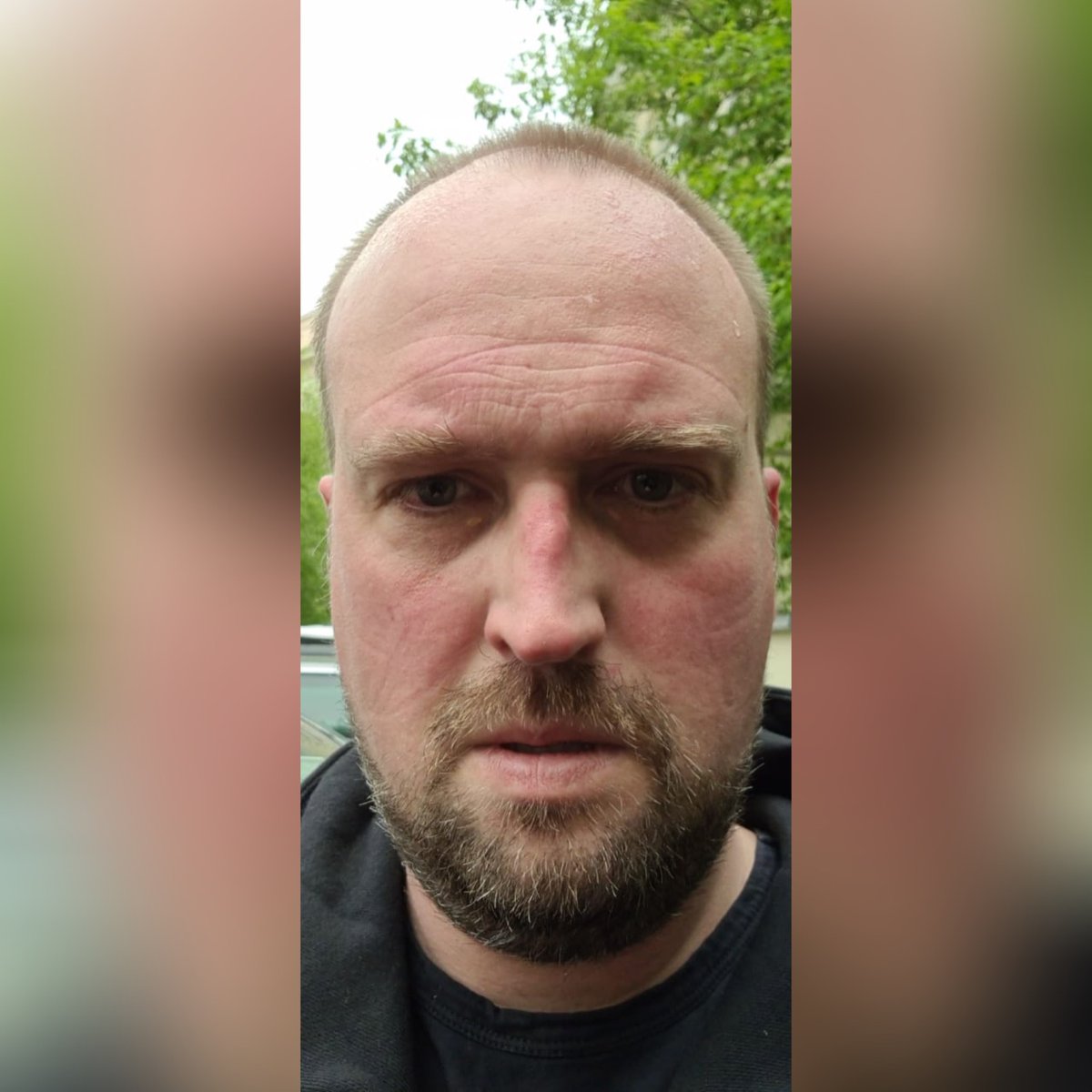 Главный врач «Спартака» Михаил Бутовский провел первую смену в отделении анестезиологии и реанимации Клиники имени В.Х.Василенко, оказывая медицинскую помощь пациентам с COVID-19.

Желаем Михаилу Сергеевичу здоровья и сил на передовой линии борьбы с эпидемией! 

#coronaout