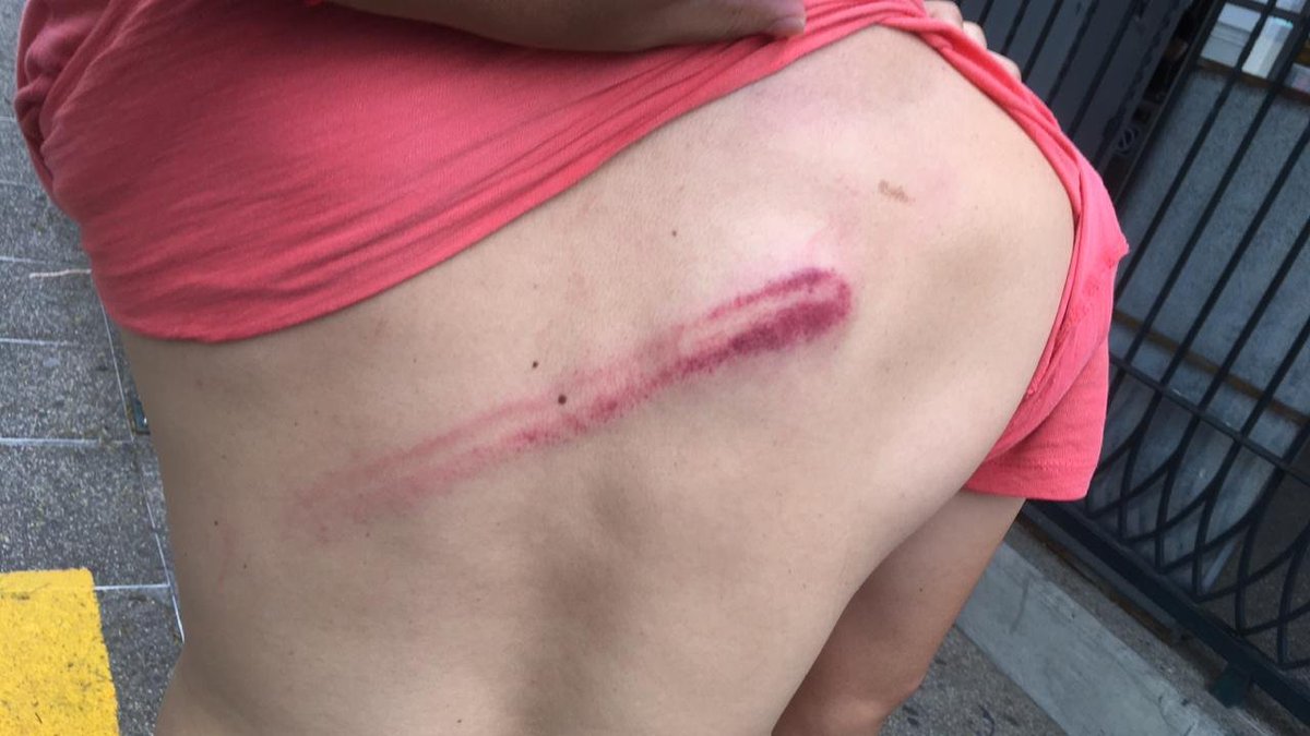 SDonziger's tweet photo. My solidarity with citizens in Ecuador who were brutally beaten today during peaceful protest of funding cuts for education by President @Lenin -- the same man who in March paid $325 million to Wall Street bondholders during the height of the COVID pandemic. https://t.co/hzakFvVkki