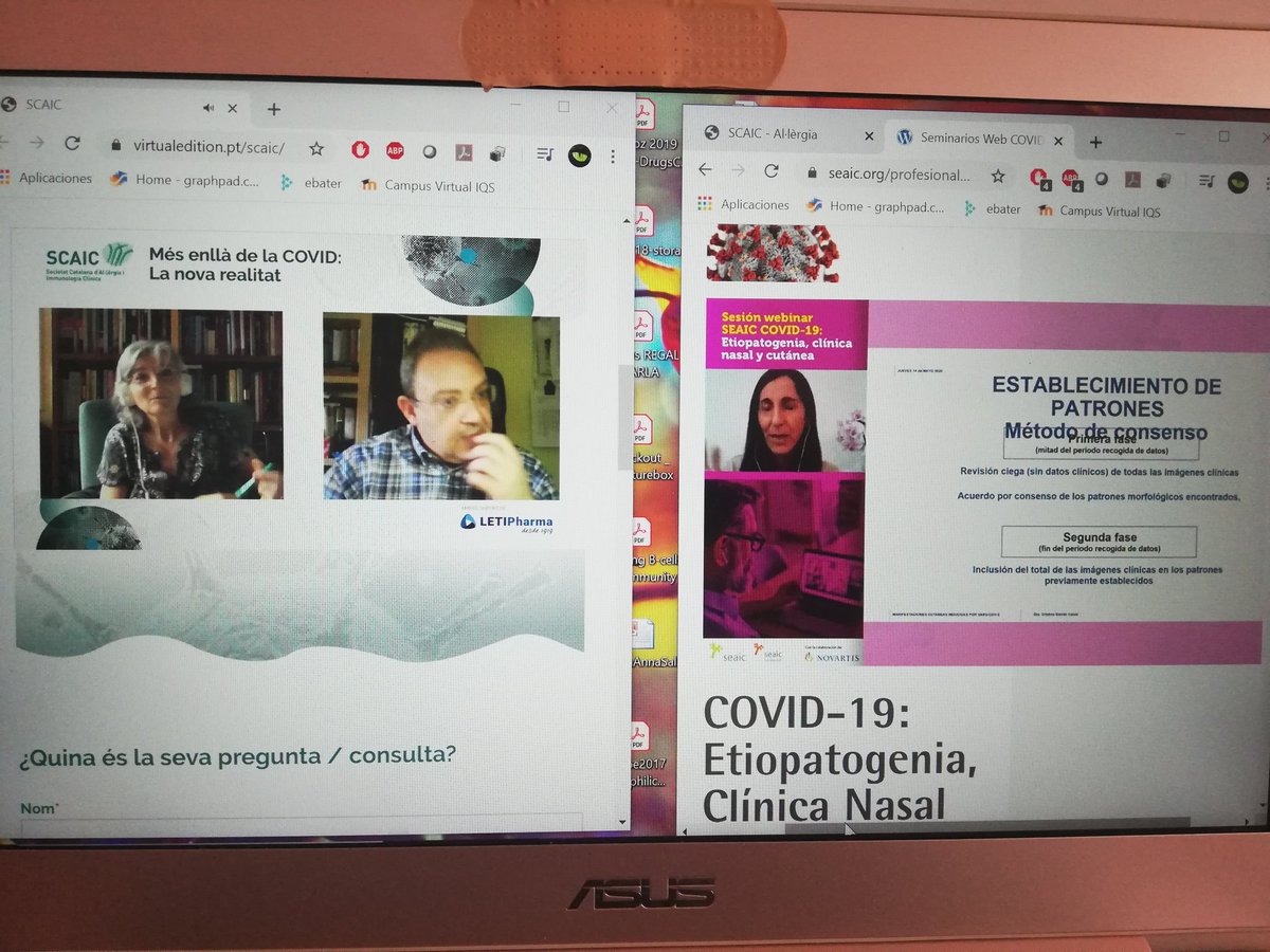 Pgalvan_blasco's tweet photo. Me apunto al retode @vickycardona #neverEnough #WEBINAR!!!
Sí se puede! 😉😉
#estereoWEBINAR
#WEBINARmaster
@scaic_cat @SEAIC_Alergia @CAJMIR_SEAIC https://t.co/mSaxqZEhII
