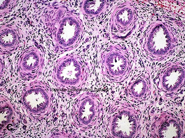 Pathology_2020's tweet photo. @Pathology_2020 
#Renal #Pathology
#OnlineConference
Submit your #Abstracts at: https://t.co/B5gUiCmO9y &amp; visit: https://t.co/UMa0Rre93o to know more about the conference

#pathology #conference #renal #path #science #research #medical #biology #clinicaltrails #biolife #doctors https://t.co/RzNY7r9FGo