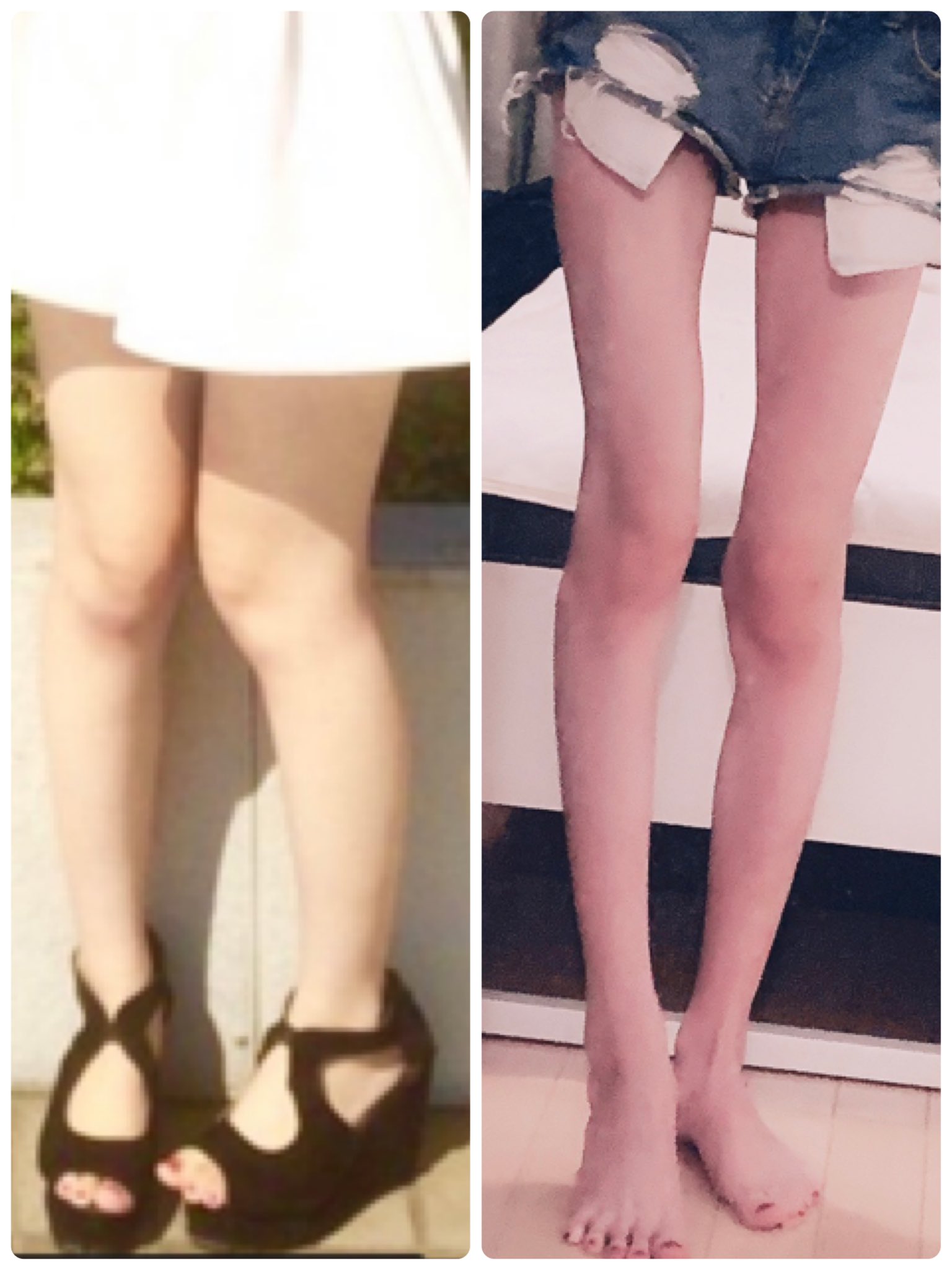 上條唯 脚 痩せの質問多いので新しくまとめました やはり下半身は上半身に比べて痩せにくいです 大体5キロから見た目変わってきます もうこれが1番効いた とかはないです 体重落ちれば勝手に細く なる ガリガリが嫌なら筋トレしよ Max約50 Min約35