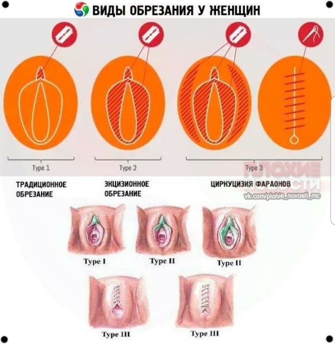 фото мал полов губки