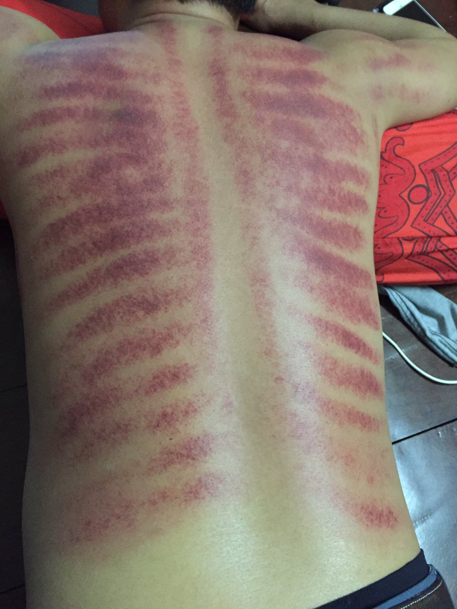 Small8Mr's tweet image. ឈឺបានសំរច