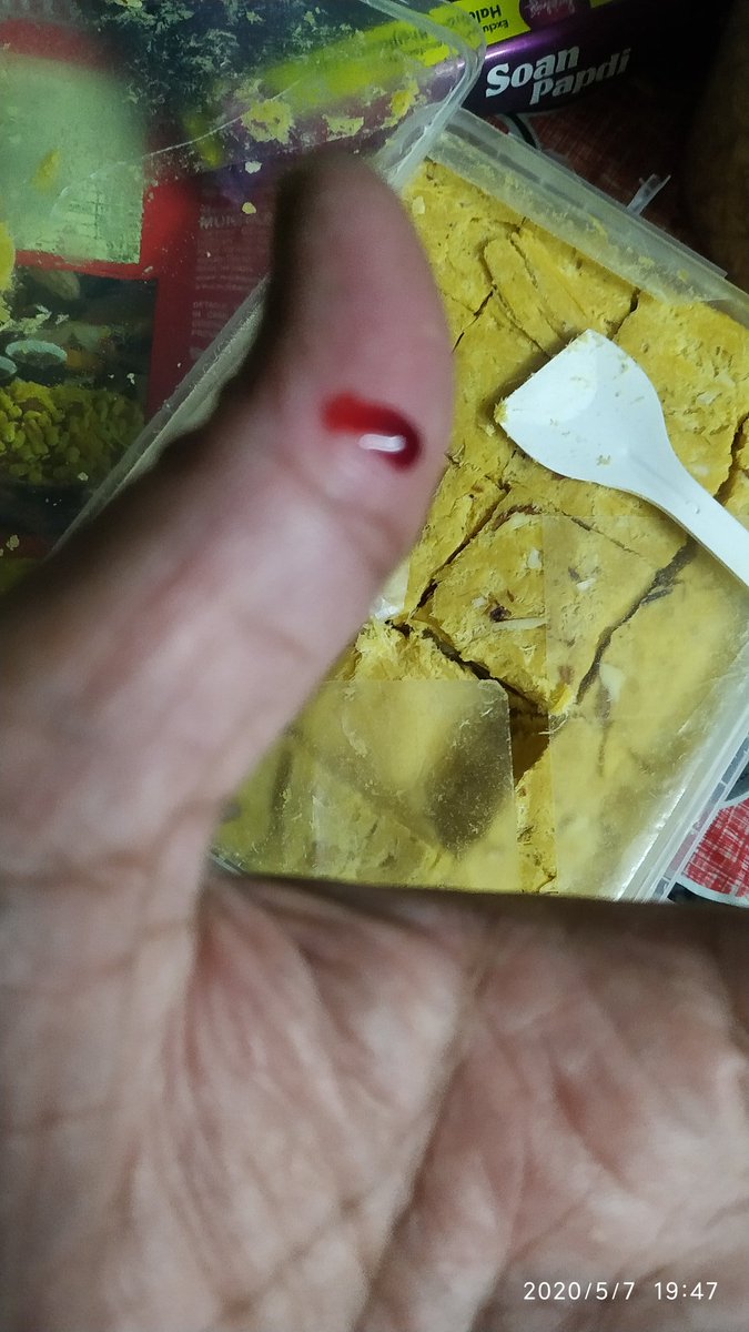 bikramvaskar's tweet image. @HaldiramsKol #WorstPackaging ever, typical of Haldiram Prabhuji. Fingers get CUT when you open the package, the seal is SO #SHARP that your fingers get cut. You really think that with quality as this, you can ever be successful in the international market. @timesofindia @WIONews