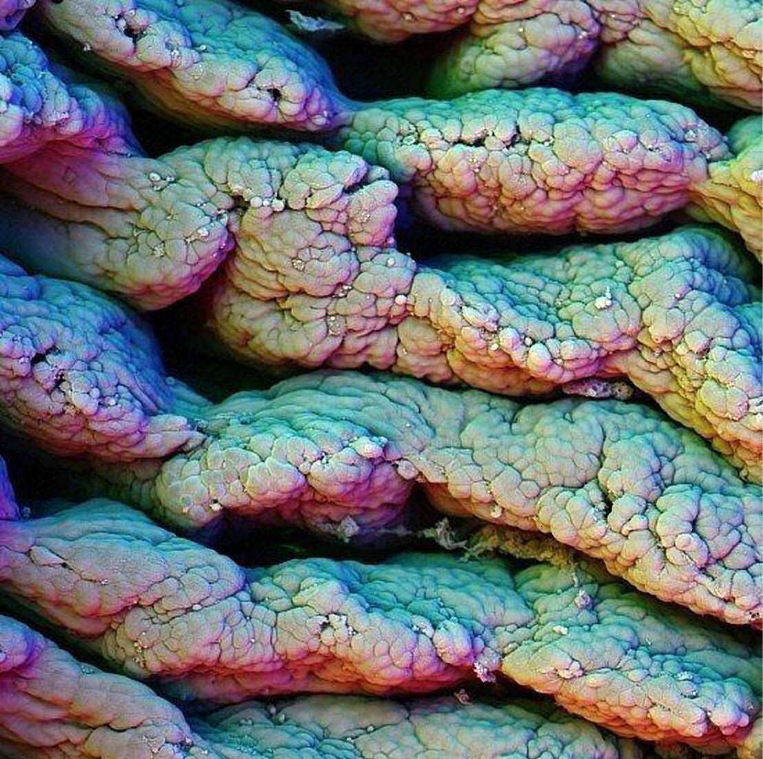MicroscopcWorld's tweet photo. Small intestine
The villi of the intestine increase the surface area of ​​the organ, which helps in the absorption of food. https://t.co/0OTBfu8mHm