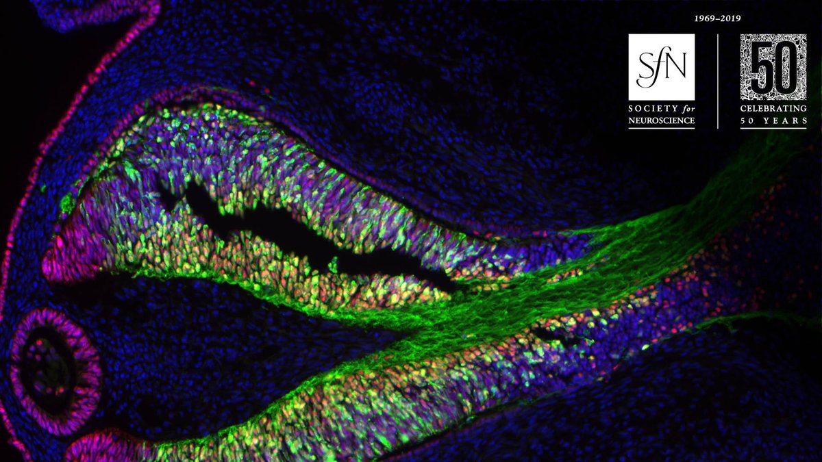SfNtweets's tweet photo. Need a virtual background for your next #Zoom call with family, friends, or colleagues? We've made a range of photos available for digital download on https://t.co/gw0oKDSo73. These artists’ images have been featured on eNeuro &amp; JNeurosci. Download now: https://t.co/YSJaPpQTEQ https://t.co/Rm5GcD57Eb