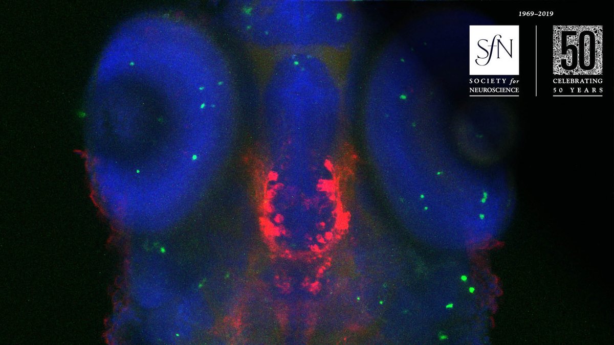SfNtweets's tweet photo. Need a virtual background for your next #Zoom call with family, friends, or colleagues? We've made a range of photos available for digital download on https://t.co/gw0oKDSo73. These artists’ images have been featured on eNeuro &amp; JNeurosci. Download now: https://t.co/YSJaPpQTEQ https://t.co/Rm5GcD57Eb