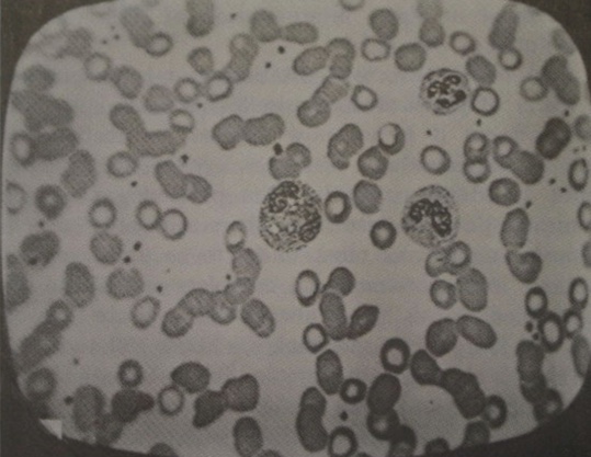 MGHPathology's tweet photo. #Telemedicine is being used much more widely during the #COVID19 pandemic ๐๐ฒ
#DYK the @BostonLogan/@MassGeneralNews Telemedicine Program was pioneered in 1963 using Television Microscopy ๐ฌ๐บ #TBT #ThrowbackThursday https://t.co/hM7jby6sda