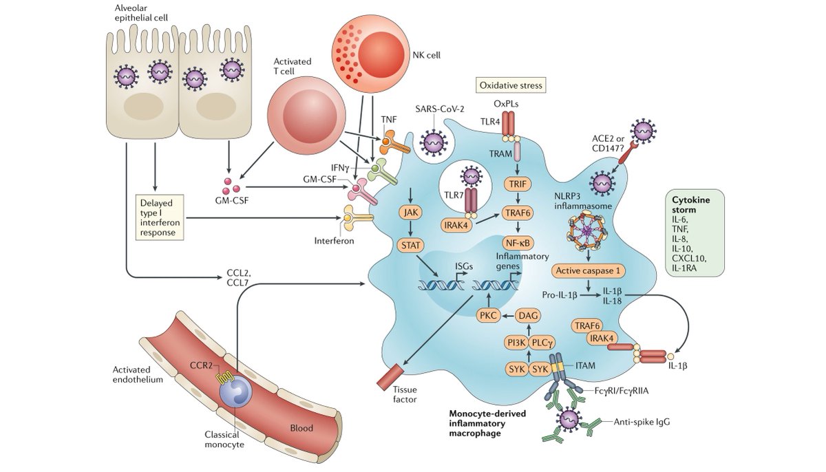 Immunopole's tweet photo. #Hyperinflammation, possibly through a dysregulated #macrophage response, contributes to disease severity in #COVID19 #patients. Among interesting therapeutic strategies : targeting the #ComplementCascade @MiriamMerad #JéromeMartin @NatRevImmunol https://t.co/u4FQXfW8Er https://t.co/dGkm3xOOBB