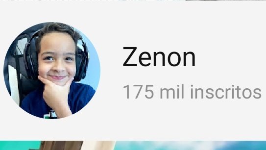 175 milhões!! 😮😮😮😮