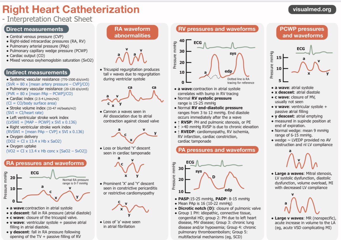 Jay Mohan, D.O., FACC, FSCAI, FASE, RPVI (@drjaymohan) on Twitter photo RHC. Makes a difference when done right. Know the waveforms. Know the nuances. Troubleshoot. Garbage in=garbage out. When used properly your job will be easier. #Cardiotwitter <a href="/Visualmedapp/">Visualmed: Clinical Trials</a> #cardiology #swanganz #rhc #Medtwitter RHC. Makes a difference when done right. Know the waveforms. Know the nuances. Troubleshoot. Garbage in=garbage out. When used properly your job will be easier. #Cardiotwitter <a href="/Visualmedapp/">Visualmed: Clinical Trials</a> #cardiology #swanganz #rhc #Medtwitter
