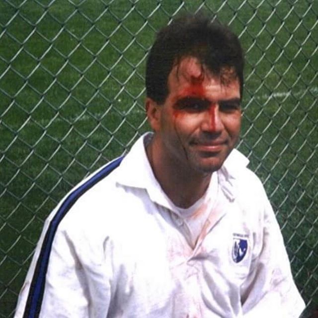 Celebrating this #throwbackthursday with a shot of founder Vic Thomas on the sidelines waiting for stitches... Give Blood! Play Rugby 🏉 ❤️ Swipe ➡️ to check out our tee and tank selection and tag a friend who’s been there! 
#rugby #rugbylove #givebloodplayrugby #rugbylicious
