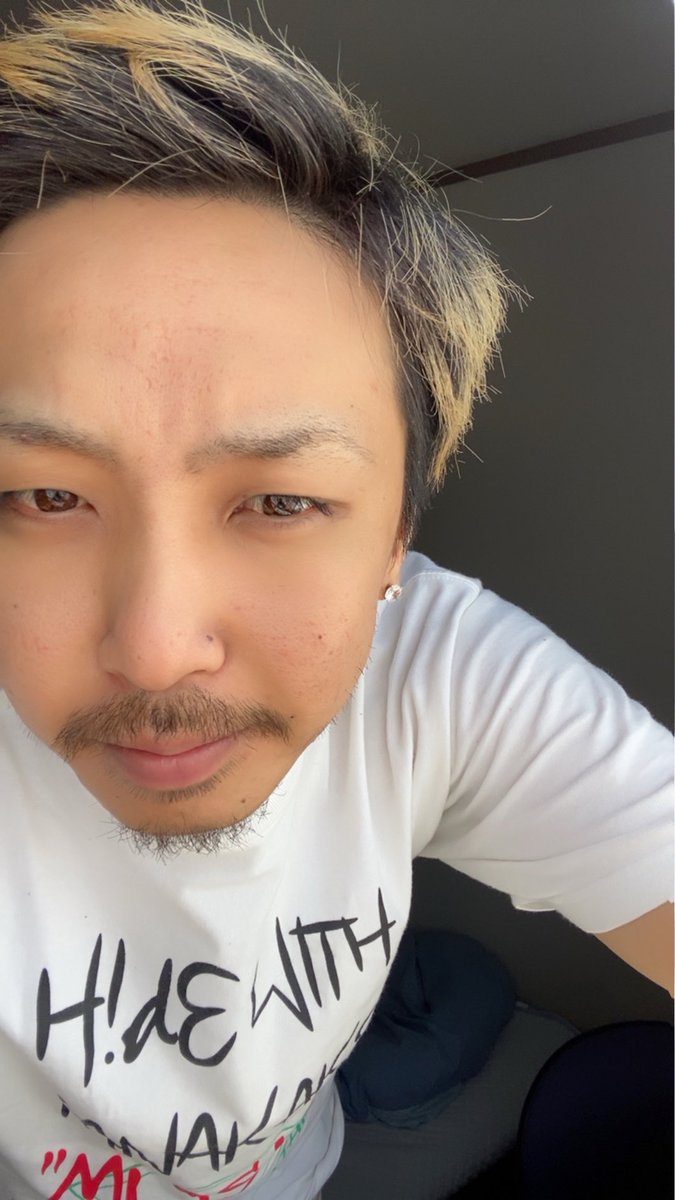 ナラノボル スマイルアンドグッド Twitterissa この期間 どうせならどれだけ髭が伸びるのかなぁって 試しに伸ばしてるんですが 一定まで伸びると伸びが悪くなるんですねぇ 笑 ヒゲ飽きてきた 笑 ナラノボル スマイルアンドグッド Twitterissa この期間 どうせならどれだけ髭が伸びるのかなぁって 試しに伸ばしてるんですが 一定まで伸びると伸びが悪くなるんですねぇ 笑 ヒゲ飽きてきた 笑