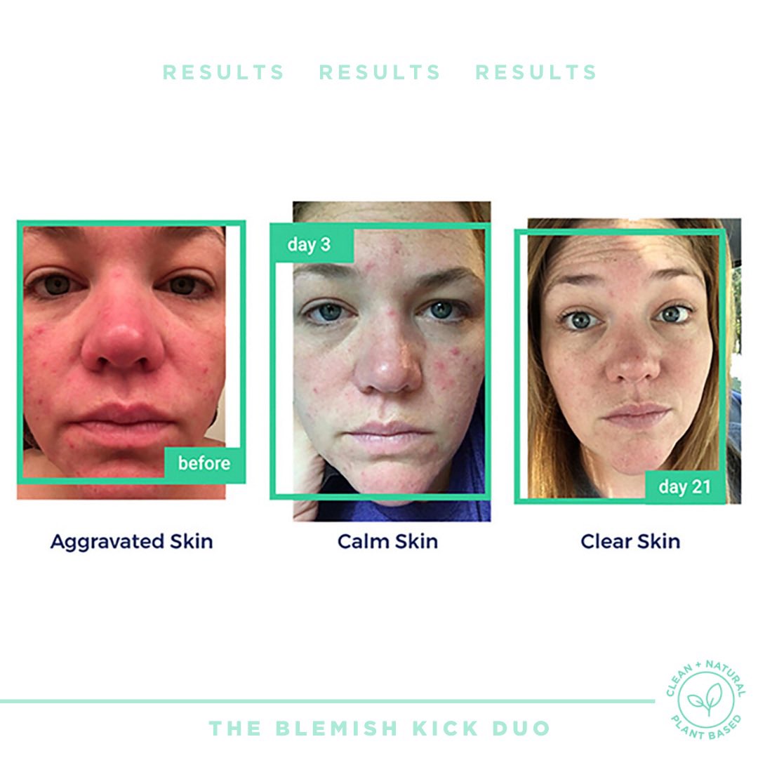 SkinKick's tweet photo. 3 DAYS + THEN 21 DAYS! Now that is how you become clear + confident 🙌💙🌿 #SkinKick #KickIt #skincare https://t.co/nfXd3zM9eb