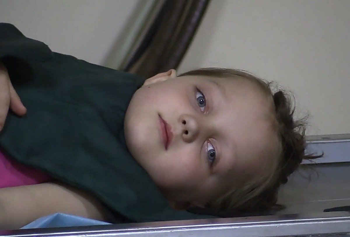 TamrikoT's tweet photo. As a result of yesterday’s shelling in the outskirts of #Donetsk children were injured.Their condition is satisfactory as per the deputy director of the republican trauma center #DPR
#StopUkraineNazis from murdering & torturing civilians in Donbass
@BBCWorld @CNN @hrw @OSCE @UN https://t.co/xaYL0EZjGa