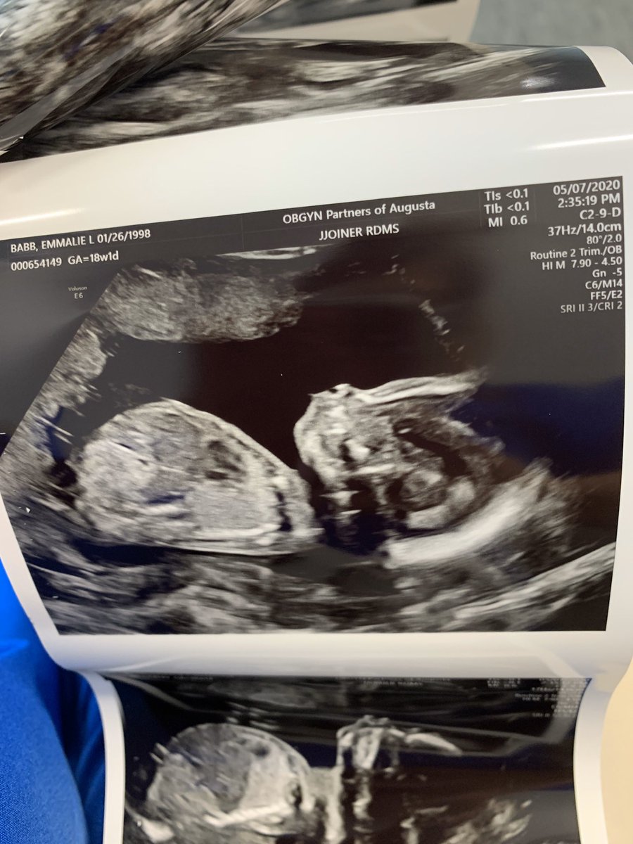 TheMamaBabb's tweet photo. Little bubba looks like he’s going to be a tall boy like his big bubba! He weighs 0.5 lbs right now and is healthy! I can’t wait to meet you my precious boy 💙 https://t.co/fafh53S12S