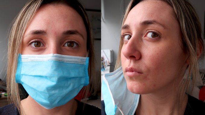Jamess12316's tweet photo. As if living through a global pandemic wasn't hard enough... enter a brand new skin issue. It's called Mask-Ne (Mask Acne). https://t.co/f8xUjRFToK