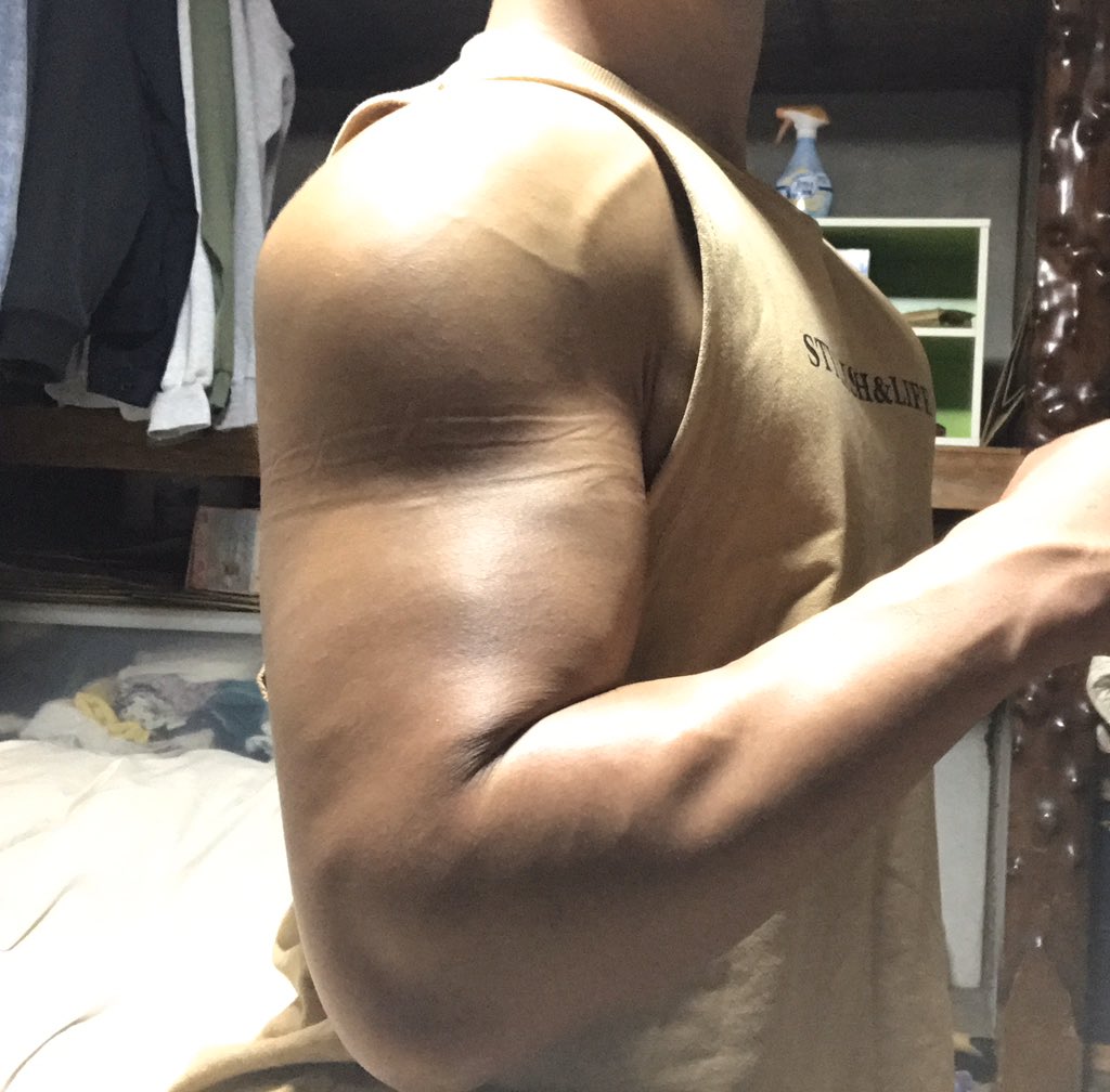 細胞核オーバーロード