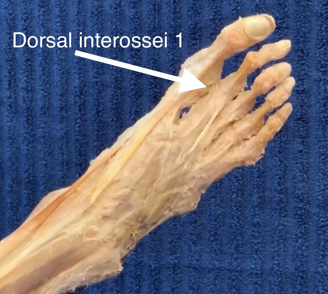 Plantar Interosseous