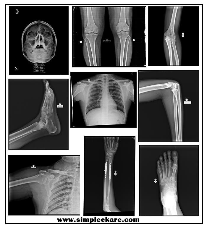 SimpleeKare's tweet photo. Finding it difficult to get your X-Ray done during this lockdown period? We are here for you in #Bhubaneswar You can also book a home X-ray.
Contact us: +916371966229
Visit us: https://t.co/yWbhBeCMAW
#DigitalXRay #xraylab #bbsr #homecare #homexray #Stayhome #Staysafe #Lockdown https://t.co/DCAICwszop