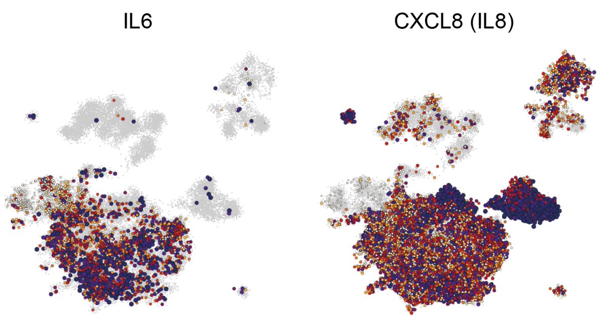 Immune lung cells in the severe patients are dominated by infiltrating myeloid cells, characterized by inflammatory signaling, including the cytokines IL6 and IL8. 8/13