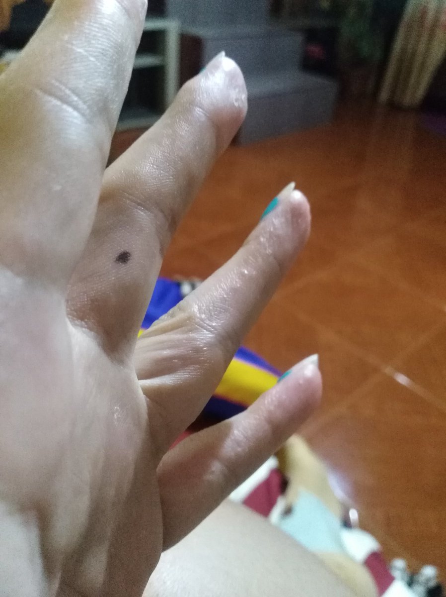 wilabJA's tweet photo. Allergy be like 🙍🤦 https://t.co/OlE5hNfGgs