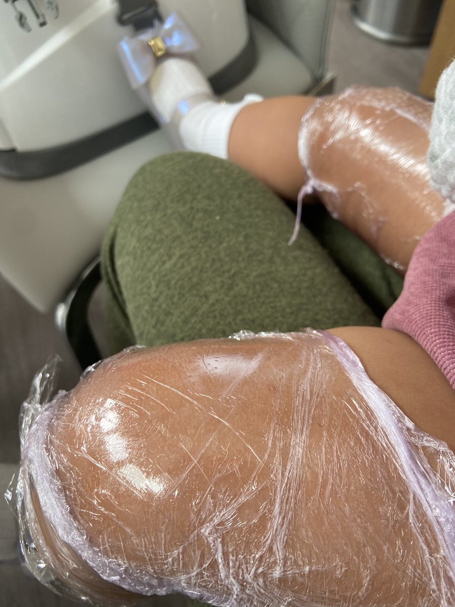 goggleboxemma's tweet photo. Talk about improvisation 😂 cling film to the rescue .. took our minds of the immunisations I suppose .. however check out the shoes @FollowWestwood #minimelissa had to dress up for the occasion .. a day of snuggles for us 😍🥰 https://t.co/fTZbe4k2ZO