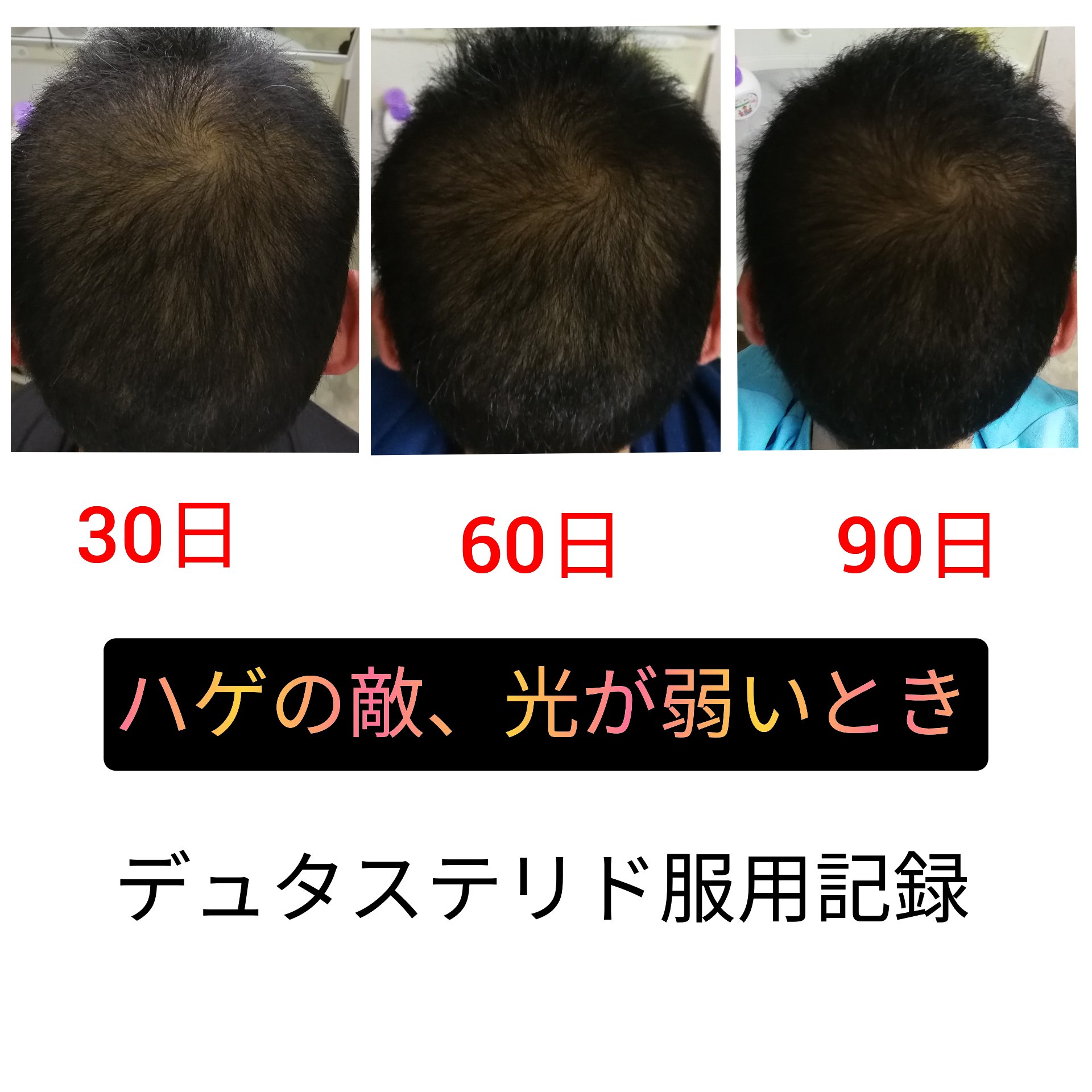 後頭部ハゲ Twitter Search Twitter