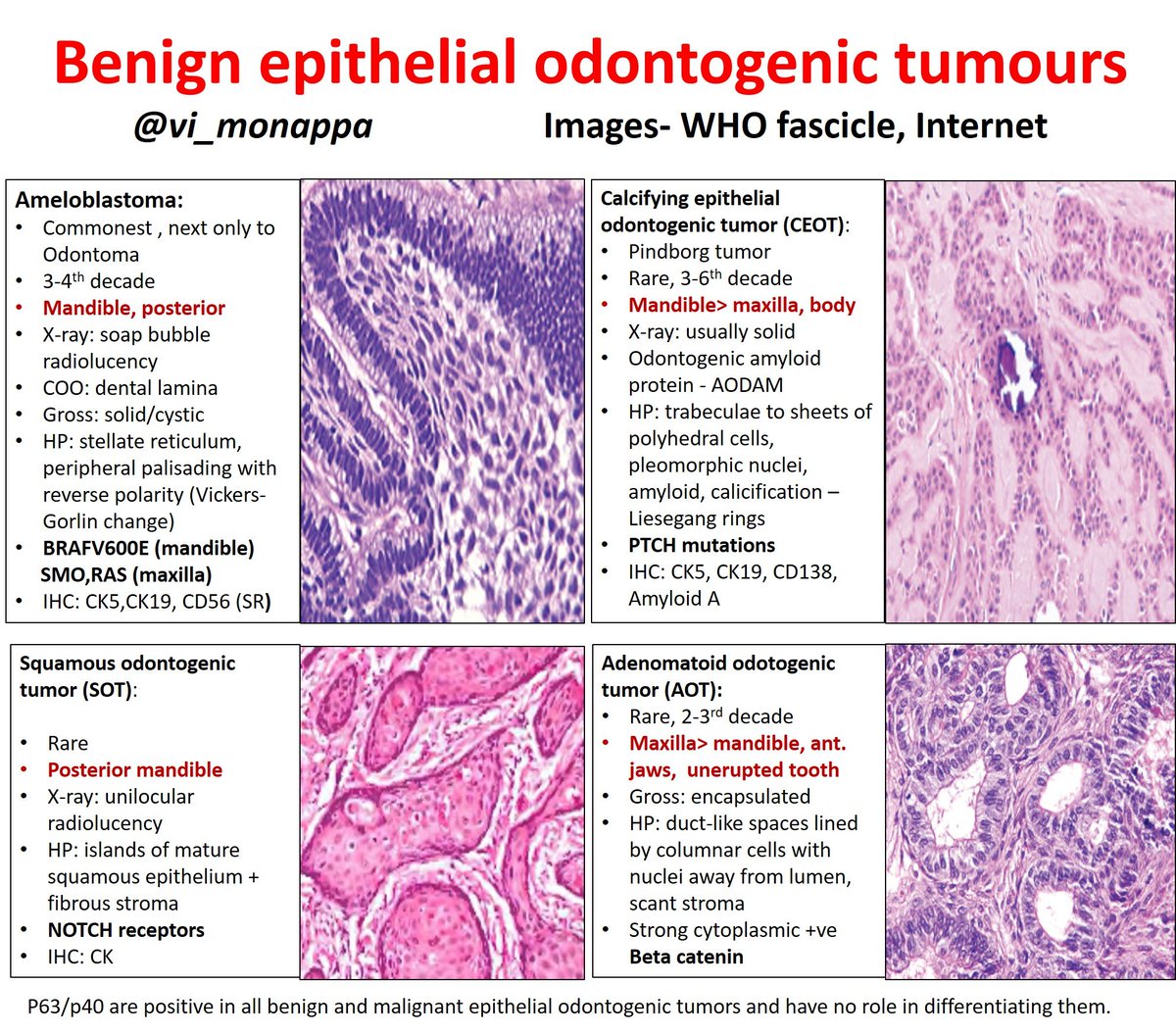 #pathboards #pathology #odontogenictumors
Do you remember the names of all the Odontogenic tumors? If no...here is a simple way to remember!! Benign epithelial odontogenic tumors @kriyer68 @pembeoltulu @SwikrityUMD @PathologySayah