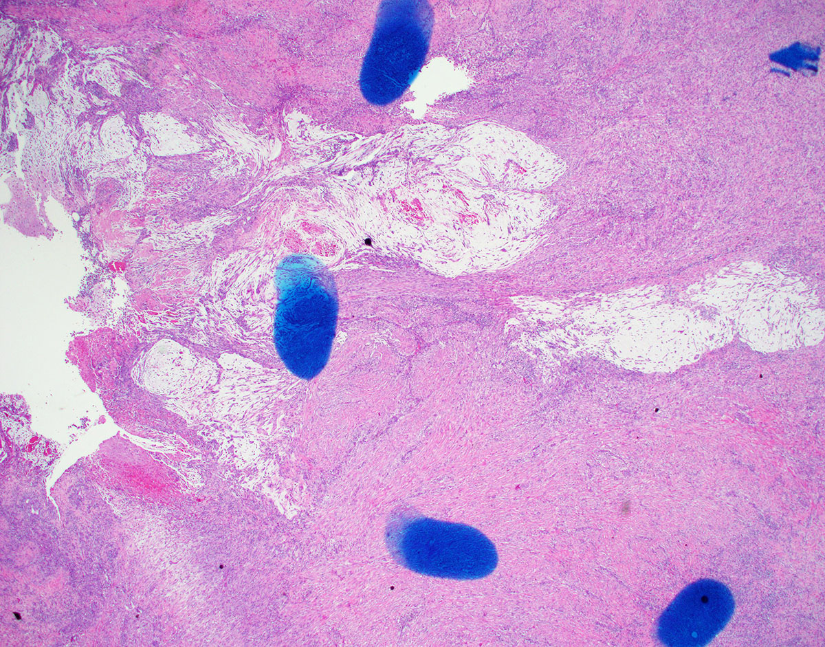 David Hernandez Gonzalo tweet media