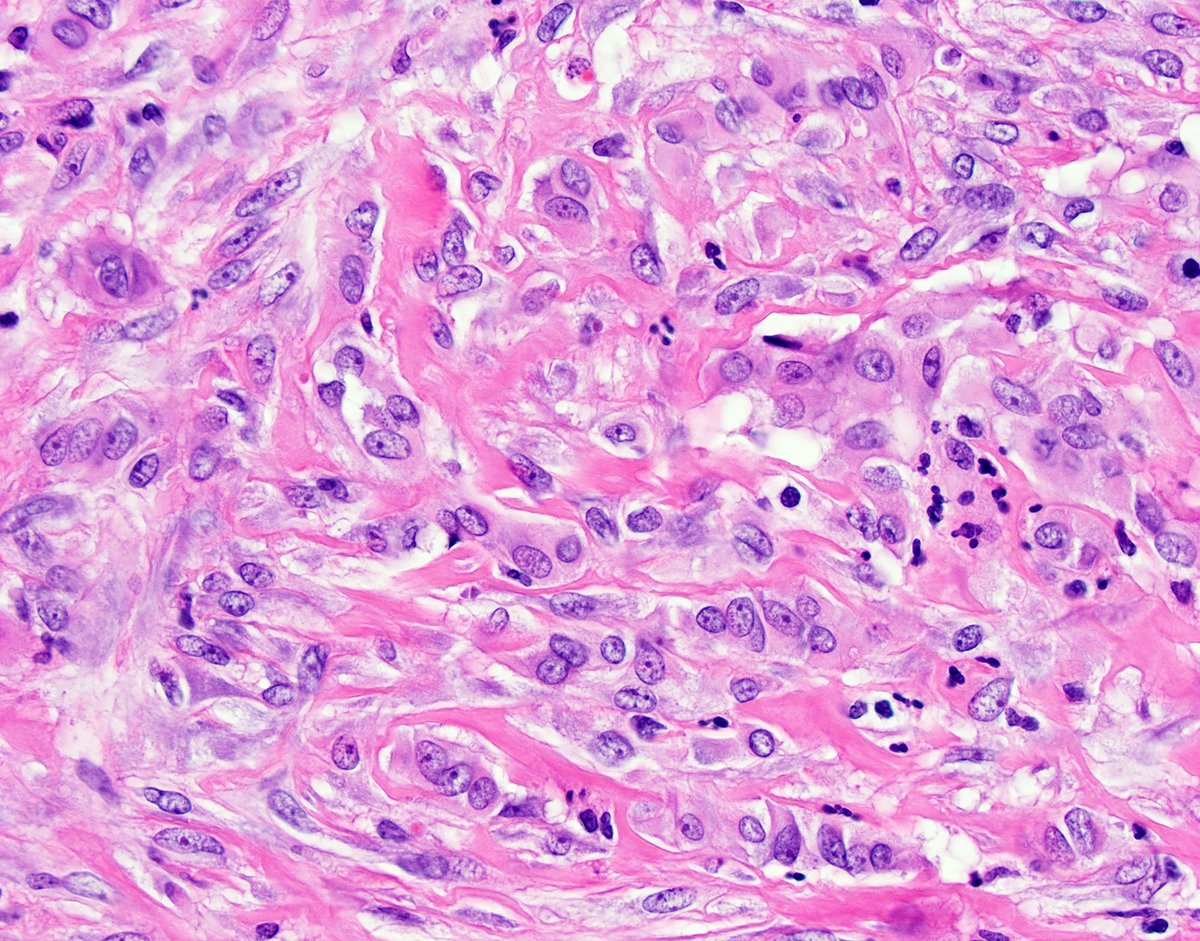 David Hernandez Gonzalo tweet media