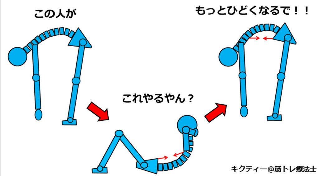 kikuty_training's tweet image. 腹筋を鍛えると腰痛が治る、という単純な考えは危険です

もちろんその人の状態によりますが、悪化させるリスクもあります

例えば前屈をする時に腰が曲がりやすい人が、シットアップをやってもさらに曲がりやすくなります

結果的に腰の負担を増やしてしまうことにも繋がります
