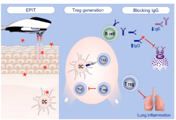 #AllergyRev20 tecnología puntera en la inmunoterapia!