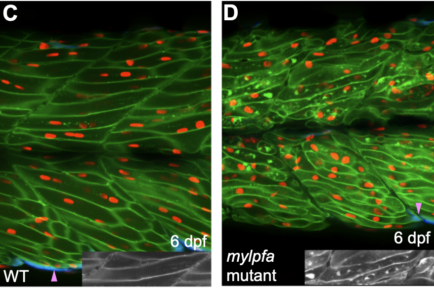 <a href="/LabTalbot/">TalbotLab</a> showed mylpf exclusively expressed in fast-twitch muscles. Zebrafish mutants had lower myosin activity =&gt; paralyzed pectoral fins (aka fish limbs). Muscle membrane structure disorganized too, but only among fast-twitch fibers 6/10