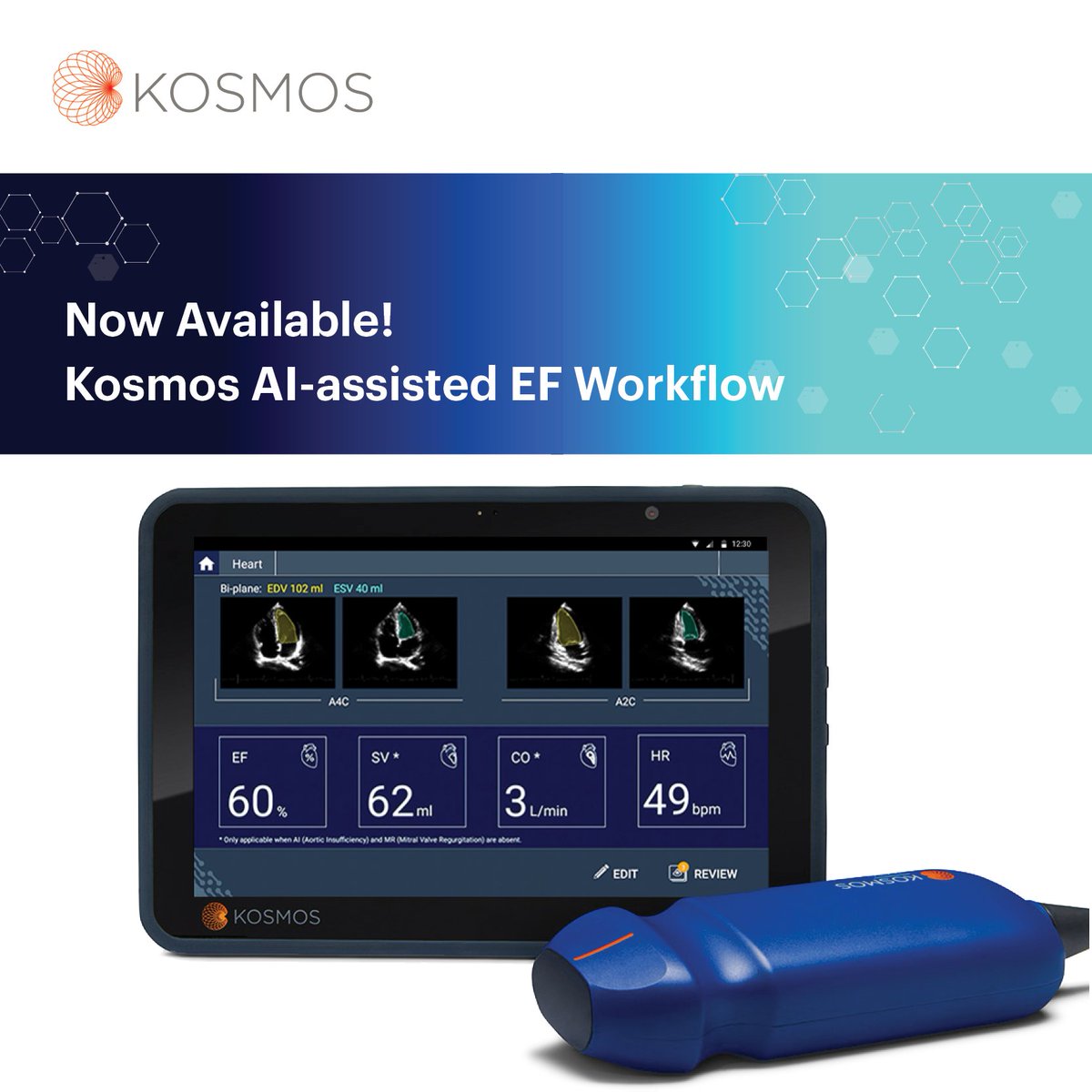 EchoNous_Inc's tweet photo. AI-assisted ejection fraction is here! Assess systolic heart function with KOSMOS right at the bedside.
To experience our AI-assisted ultrasound + echo, comment below and we'll connect you with the right person!
#ultrasound #pocus https://t.co/AN9VP2JMBK