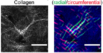 fischbcl17's tweet photo. Ever wondered how collagen microarchitecture and stiffness interface to regulate myofibroblast differentiation? @NCIPhySci collaboration @Bori_Seo w Vivek Shenoy and terrific current/former @CornellBME @LuLing3 @song_younghye @Karin_Wang26 @adshimpi1 

https://t.co/T7nMYFUaQ3. https://t.co/MvWBRnzwaE