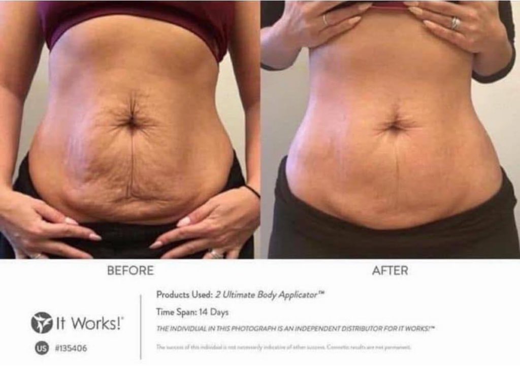 Beauty_Beyond15's tweet photo. Who trying to tone their body up try our Ultimate Body Applicator and Fab Wrap you see the outcome why pass up this!! Going to have your body looking nice🔥❤️ and it’s only $69 right now with my discount comment down below if interested! https://t.co/rdafovusGj
