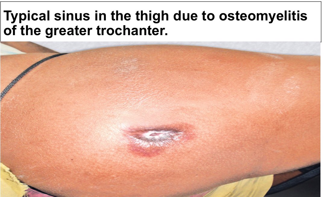 Hello 😍😍💕 Friends of my way♥️♥️😍 Today we are talking about Common