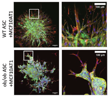 fischbcl17's tweet photo. Interested in how obesity may promote tumor invasion and which role stromal cell-mediated ECM remodeling plays in this process? Terrific @CornellBME collaboration of @LuLing3 with @SteveAdie1 using some beautiful imaging. https://t.co/qYRSEcquzt https://t.co/njhdb0OH4d